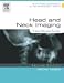 Head and Neck Imaging: Case Review Series