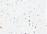 Cinelli Gel Cork Grip Tape White