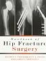 Handbook of Hip Fracture Surgery