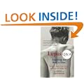 Lupus Q&A: Everything You Need to Know