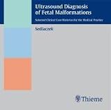 Ultrasound Diagnosis of Fetal Malformations. CD-ROM