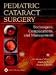 Pediatric Cataract Surgery: Techniques, Complications, and Management