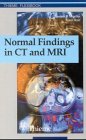 Normal Findings in CT and MRI