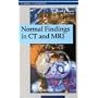 Normal Findings in CT and MRI