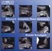 Classical Music : Mozart: Complete Piano Variations