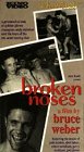Broken Noses