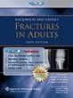 Rockwood Fracture's Solutions, 3 Volume Set