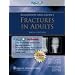 Rockwood Fracture's Solutions, 3 Volume Set
