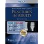 Rockwood Fracture's Solutions, 3 Volume Set