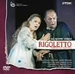 ���F���f�B:�̌��u���S���b�g�v [DVD]