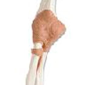Functional Elbow Joint Model