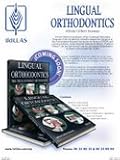 Lingual Orthodontics: The Truly Invisible Orthodontics