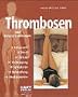 Thrombosen