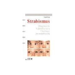 Strabismus: Diagnostik, Schielformen, Therapie