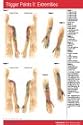 Trigger Points II: Extremities