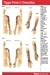 Trigger Points II: Extremities