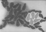 Classic Early Warning Signs of Cancer Film, This Encyclopedia Britannica film is for adults, covering the warning signs of cancer, how cancer is treated, and dispelling some old wives' tales about it, such as that it only affects old people or that it is hereditary.