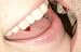 Scarecrow SMALL Blood Tip Classic Vampire Fangs from Planetcostume