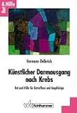 K�nstlicher Darmausgang nach Krebs