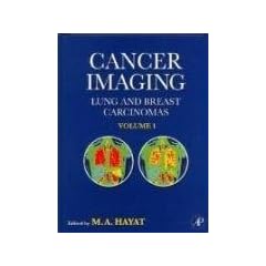 Cancer Imaging by M. A. Hayat