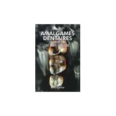 Amalgames dentaires
