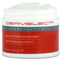 spider vein treatment