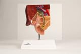 Gallstone Model