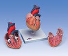 Classic Heart, 2-part
