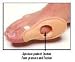 Bunion Shields - Bunion Shield, Universal
