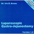 Laparoscopic Gastro-jejunostomy