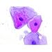 Epithelium squamous sm. of buccal mucosa (cheek cells).