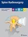 Spine Radiosurgery