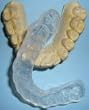 Professional Custom Soft Dental Teeth Night Guard Order Dental Lab Direct!