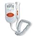 Sonoline B Professional Pocket Fetal Doppler (LCD Display with Back Light) + 250ML of UltraSound Gel