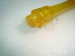 Derma Stamp by ReJuveness 1.5mm 35 Pin, A Common Cosmetic Procedure for Treating Many Conditions By Stimulating Collagen and Elastin Production. Repairs * Aged Skin * Acne Scarring * Wrinkles * Hair Loss *. In Addition Derma Stamps Boost Effectiveness Of Skincare Products Up To 80%.