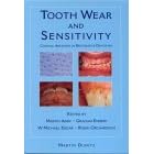 Tooth Wear and Sensitivity