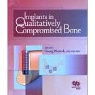 Click here to buy Implants In Qualitatively Compromised Bone by George Watzek.