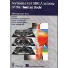 Sectional MRI Anatomy of the Human Body by S. Marinkovic