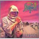 Leprosy