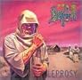 Leprosy Leprosy