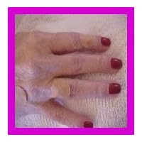 DOT MEDICAL MAGNETS for MAGNETIC THERAPY