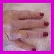 DOT MEDICAL MAGNETS for MAGNETIC THERAPY