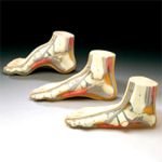 Anatomical Chart Budget Foot Model Set Of3 3/st - Model Chm312