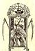 Onus Uteri [RARE]