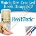 HEEL Tastic THERAPY by Ontel