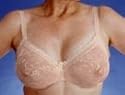 Classique Lace Underwire Mastecomy Bra for Silicone Breastforms