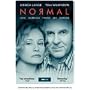 Normal