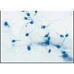 Forensic Serological Comparison Slide Set