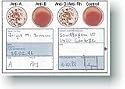 Blood Type Kits(3 Test Kits)- Test Your Blood Type and Rh Factor at Home. Follow the Blood Type Diet -Test at home in minutes! Prepare for Pandemic Flu.