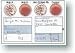 Each kit contains: a blood typing test card, sterile lancet, alcohol swab, sterile gauze plaster, comb application device, transfer pipette, color results chart, step by step instructions, and a laminating sheet to keep as permanent ID record in your wallet or purse.